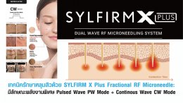 เทคนิครักษาหลุมสิวด้วย SYLFIRM X Plus Fractional RF Microneedle: มีลักษณะพลังงานพิเศษ Pulsed Wave PW Mode + Continous Wave CW Mode